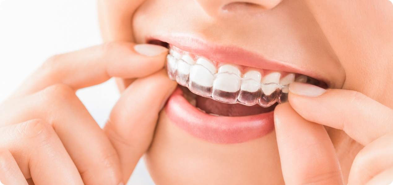 Plateforme pour accompagner les praticiens dans la gestion des traitements orthodontiques